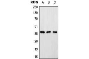 Western blot analysis of Renin Receptor expression in HeLa (A), Raw264.