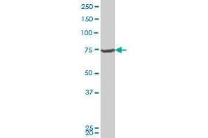 DBF4 polyclonal antibody (A01), Lot # 060614JCS1 Western Blot analysis of DBF4 expression in Jurkat . (DBF4 antibody  (AA 2-98))