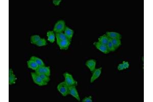 Immunofluorescence (IF) image for anti-rho-Associated, Coiled-Coil Containing Protein Kinase 2 (ROCK2) (AA 1109-1388) antibody (ABIN7168003)