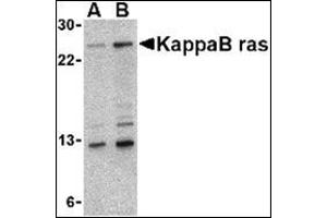 Western blot analysis of KappaB ras in 293 cell lysate with this product at (A) 2 and (B) 4 μg/ml.