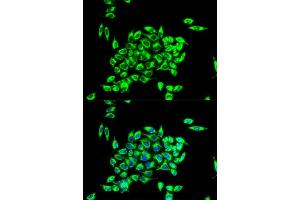 Immunofluorescence analysis of HeLa cell using TRAP1 antibody. (TRAP1 antibody)