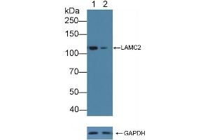 Knockout Varification: Lane 1: Wild-type A431 cell lysate, Lane 2: LAMC2 knockout A431 cell lysate, Predicted MW: 121,130kd Observed MW: 120kd Primary Ab: 5 μg/mL Rabbit Anti-Human LAMC2 Antibody Second Ab: 0.