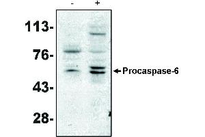 Western blot analysis using caspase-6 antibody on MCF-7 cells negative (-) and positive (+) for caspase-3 after treatment for 48 hours with thapsigargin. (Caspase 6 antibody)