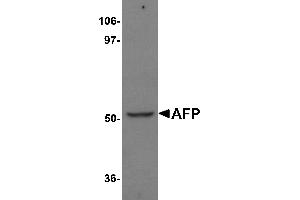Western Blotting (WB) image for anti-alpha-Fetoprotein (AFP) (N-Term) antibody (ABIN1031219) (alpha Fetoprotein antibody  (N-Term))