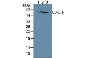 Figure. (IL7R antibody  (AA 173-260))