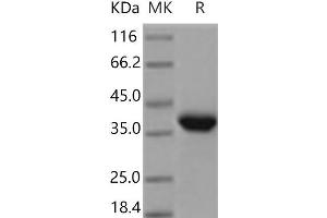 Western Blotting (WB) image for Epithelial Cell Adhesion Molecule (EPCAM) protein (His tag) (ABIN7321140) (EpCAM Protein (His tag))