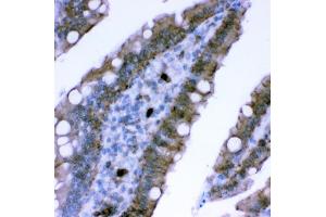 IHC analysis of Plectin using anti-Plectin antibody (ABIN3043900). (PLEC antibody  (Middle Region))