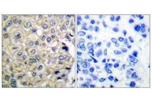 Immunohistochemistry (IHC) image for anti-Fibroblast Growth Factor Receptor 3 (FGFR3) (Internal Region) antibody (ABIN1848542)