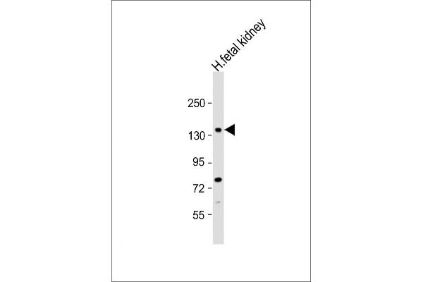 NEK1 antibody  (C-Term)