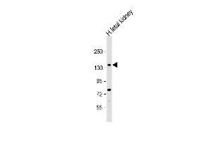 Anti-NEK1 Antibody (C-term) at 1:500 dilution + human fetal kidney lysate Lysates/proteins at 20 μg per lane. (NEK1 antibody  (C-Term))