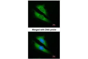 ICC/IF Image Immunofluorescence analysis of paraformaldehyde-fixed HeLa, using ATIC, antibody at 1:200 dilution. (ATIC antibody)