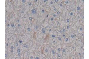 Detection of SDC1 in Human Liver Tissue using Polyclonal Antibody to Syndecan 1 (SDC1) (Syndecan 1 antibody  (AA 23-253))