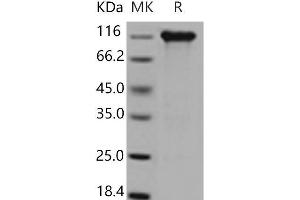 CD130/gp130 Protein (His tag,Fc Tag)