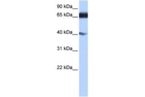 Western Blotting (WB) image for anti-Zinc Finger Protein 879 (ZNF879) antibody (ABIN2463463) (ZNF879 antibody)