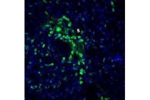Expression of Slitrk2 in rat striatum - Immunohistochemical staining of perfusion-fixed frozen rat brain sections with Anti-Slitrk2 (extracellular) Antibody (ABIN7043630, ABIN7045306 and ABIN7045307), (1:200), followed by goat anti-rabbit-AlexaFluor-488. (SLITRK2 antibody  (Extracellular, N-Term))