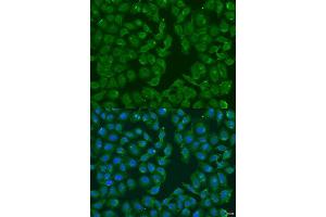 Immunofluorescence analysis of U2OS cells using MSRB3 antibody. (MSRB3 antibody  (AA 1-185))