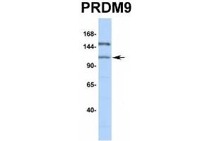 Host:  Rabbit  Target Name:  PRDM9  Sample Type:  293T  Antibody Dilution:  1.