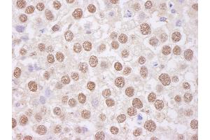 Immunohistochemistry (IHC) image for anti-TAF15 RNA Polymerase II, TATA Box Binding Protein (TBP)-Associated Factor, 68kDa (TAF15) (AA 200-250) antibody (ABIN7453406)