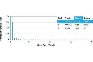 Protein Array (PAr) image for anti-Protein Phosphatase 1, Regulatory (Inhibitor) Subunit 1B (PPP1R1B) antibody (ABIN7455991)