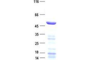 Western Blotting (WB) image for Methyltransferase 5 Domain Containing 1 (METT5D1) protein (His tag) (ABIN5505718)