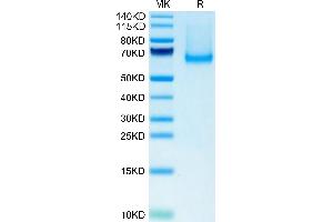Mouse Siglec-5/CD170 on Tris-Bis PAGE under reduced condition. (SIGLEC5 Protein (AA 17-439) (His tag))