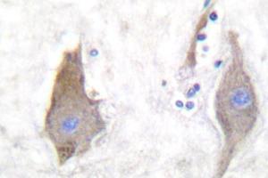 Image no. 2 for anti-Synuclein, alpha (SNCA) antibody (ABIN271837) (SNCA antibody)