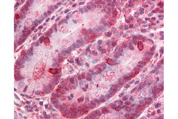 ZNF687 antibody  (C-Term)