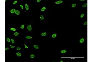 Immunofluorescence of purified MaxPab antibody to RALYL on HeLa cell. (RALYL antibody  (AA 1-291))