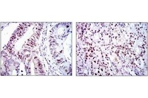 Immunohistochemistry (IHC) image for anti-Cyclin-Dependent Kinase 2 (CDK2) antibody (ABIN1106645) (CDK2 antibody)