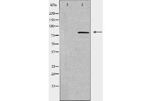 Western blot analysis of extracts from COLO cells, using NCAPH antibody. (NCAPH antibody  (Internal Region))