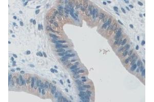 Immunohistochemistry (IHC) image for anti-Tumor Necrosis Factor Receptor Superfamily, Member 11a, NFKB Activator (TNFRSF11A) (AA 359-542) antibody (ABIN7439945)