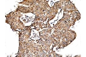 IHC analysis of TIMM29 using anti-TIMM29 antibody (ABIN7601495). (TIMM29 antibody  (AA 37-260))