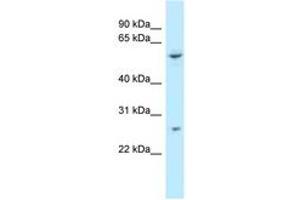 Image no. 1 for anti-Tetratricopeptide Repeat Domain 39B (TTC39B) (AA 378-427) antibody (ABIN6747851) (TTC39B antibody  (AA 378-427))