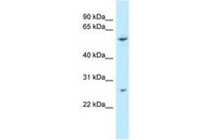 Image no. 1 for anti-Tetratricopeptide Repeat Domain 39B (TTC39B) (AA 378-427) antibody (ABIN6747851)