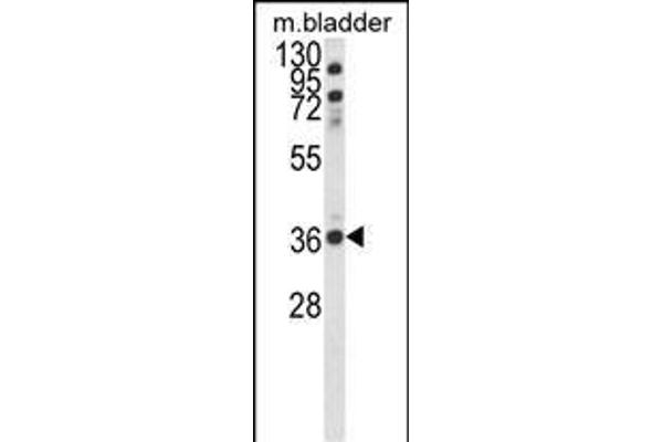CCDC3 antibody  (C-Term)