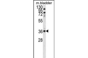 Western blot analysis of CCDC3 Antibody (C-term) (ABIN652692 and ABIN2842461) in mouse bladder tissue lysates (35 μg/lane). (CCDC3 antibody  (C-Term))