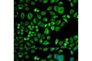 Immunofluorescence analysis of A549 cells using APOD Polyclonal Antibody (Apolipoprotein D antibody)