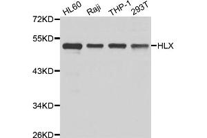 Western blot analysis of extracts of various cell lines, using HLX antibody (ABIN5975531) at 1/1000 dilution. (HLX antibody)