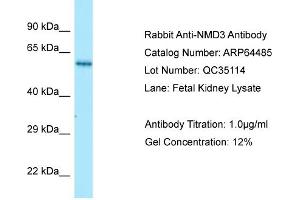Western Blotting (WB) image for anti-60S Ribosomal Export Protein NMD3 (NMD3) (C-Term) antibody (ABIN2789851) (NMD3 antibody  (C-Term))