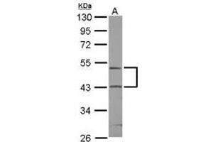 Image no. 1 for anti-RUN Domain Containing 3A (RUNDC3A) (AA 4-236) antibody (ABIN1500742)