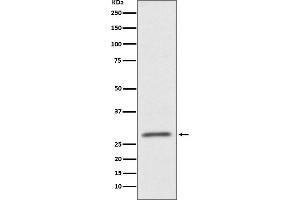 Western blot analysis of CD99 expression in HUVEC cell lysate. (Recombinant CD99 antibody)