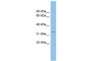 WB Suggested Anti-ACP5 Antibody Titration:  0. (ACP5 antibody  (N-Term))