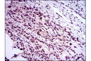 Immunohistochemistry (IHC) image for anti-E2F Transcription Factor 1 (E2F1) (AA 69-223) antibody (ABIN969516)