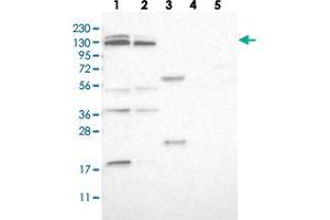 Western blot analysis of Lane 1: RT-4, Lane 2: U-251 MG, Lane 3: Human Plasma, Lane 4: Liver, Lane 5: Tonsil with SLC38A10 polyclonal antibody  at 1:250-1:500 dilution. (SLC38A10 antibody)