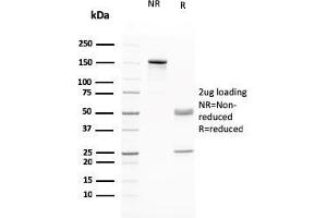SDS-PAGE Analysis Purified RAD51 Mouse Monoclonal Antibody (RAD51/2765. (RAD51 antibody  (AA 1-134))