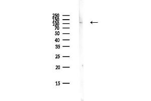 Western blot analysis of lysates from Mouse lung, using Hexokinase 1 Antibody at 1/1000 dilution.