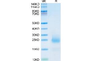 Mouse CCL24 on Tris-Bis PAGE under reduced condition. (CCL24 Protein (AA 27-119) (His tag))