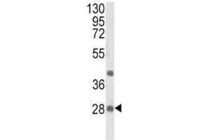 Western blot analysis of EIF4E2 antibody and NCI-H460 lysate. (EIF4E2 antibody)