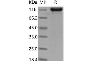 Western Blotting (WB) image for TEK Tyrosine Kinase, Endothelial (TEK) (Active) protein (Fc Tag) (ABIN7198206) (TEK Protein (Fc Tag))