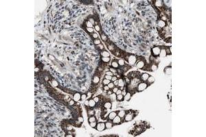Immunohistochemical staining of human colon with CHN2 polyclonal antibody  shows strong cytoplasmic positivity in granular pattern in glandular cells at 1:20-1:50 dilution. (CHN2 antibody)